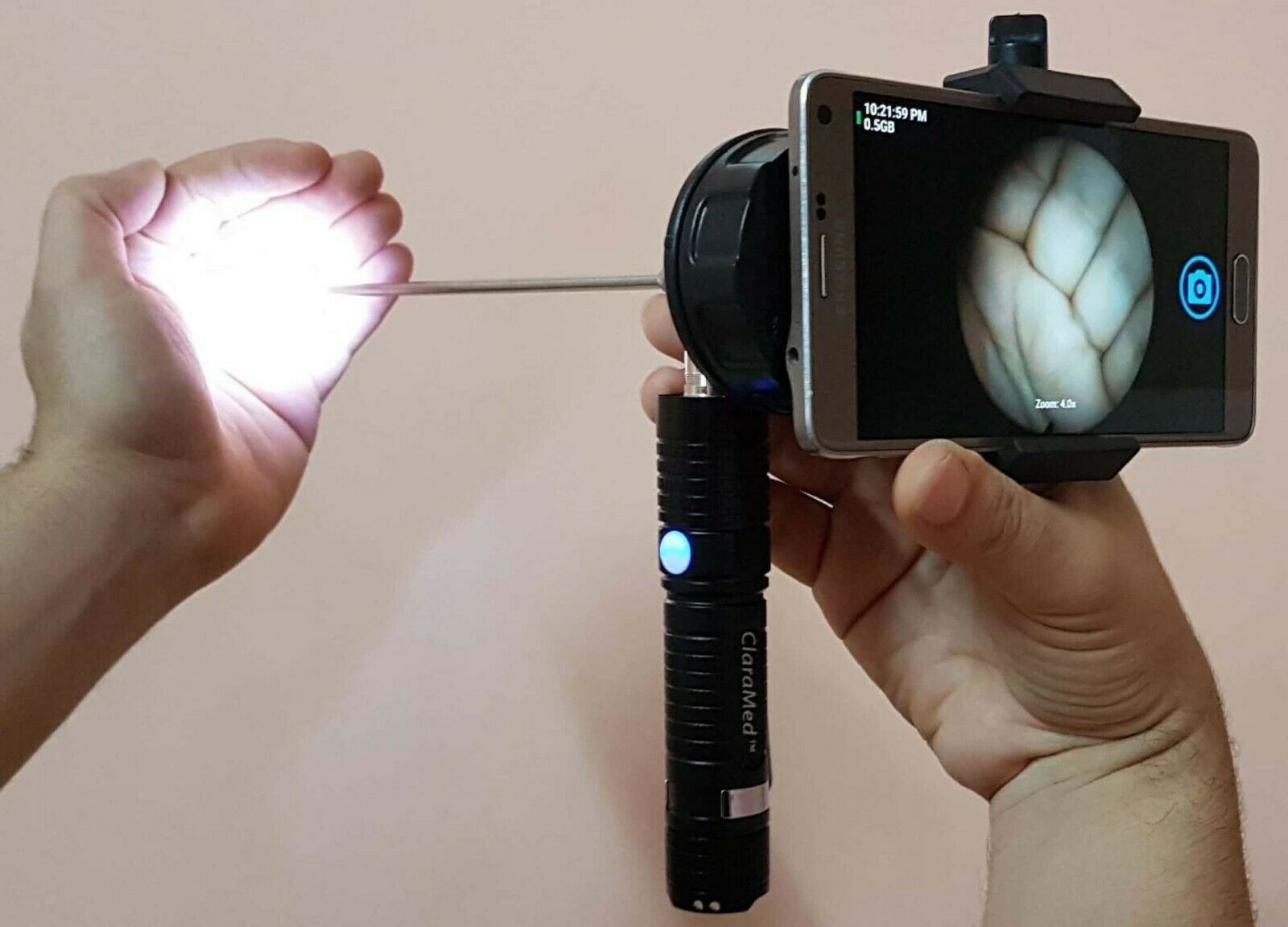 ClaraMed mobile smartphone endoscope adapter with Smart LED light source S1